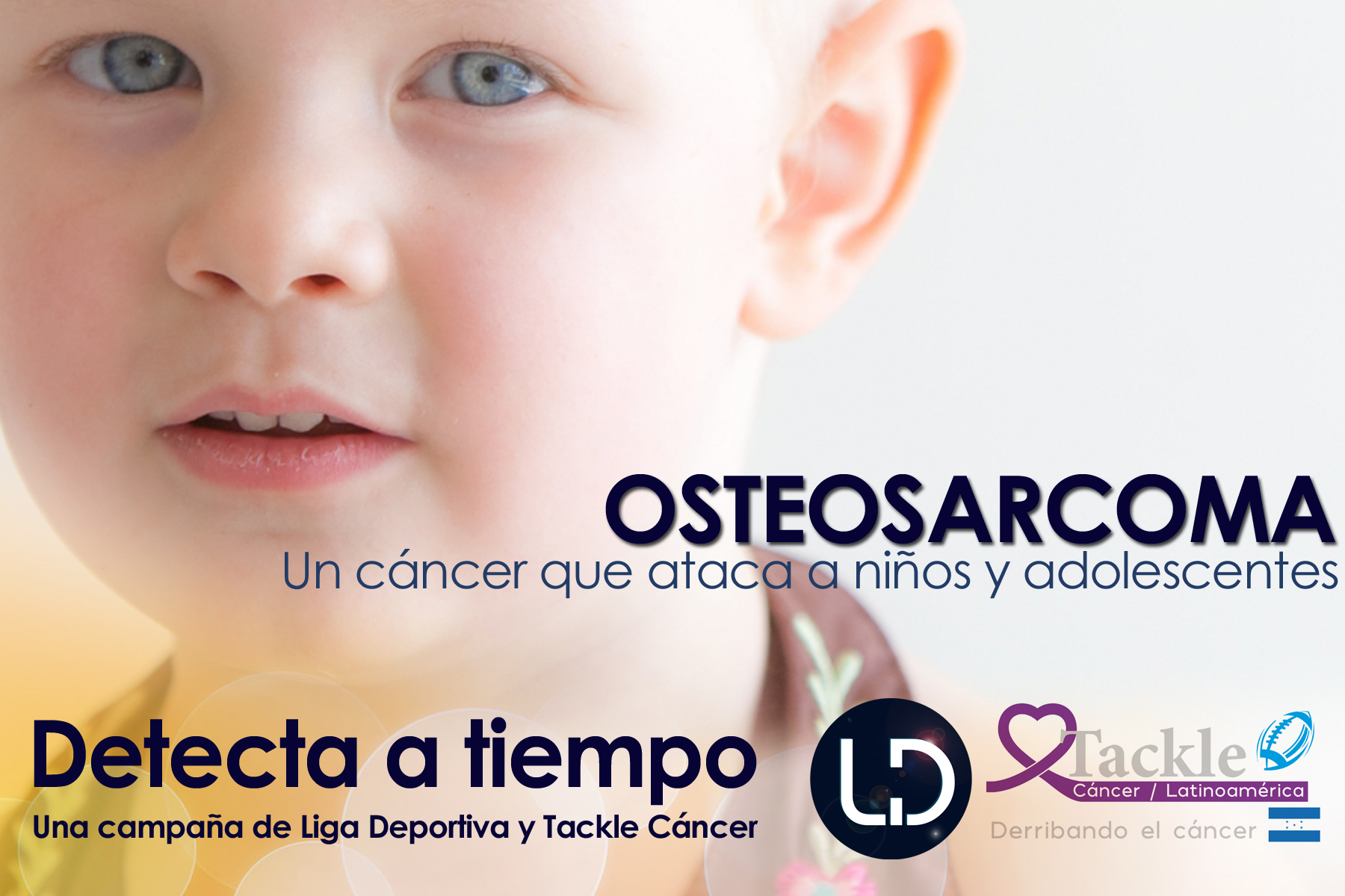 ¿Sabes que es el Osteosarcoma? 